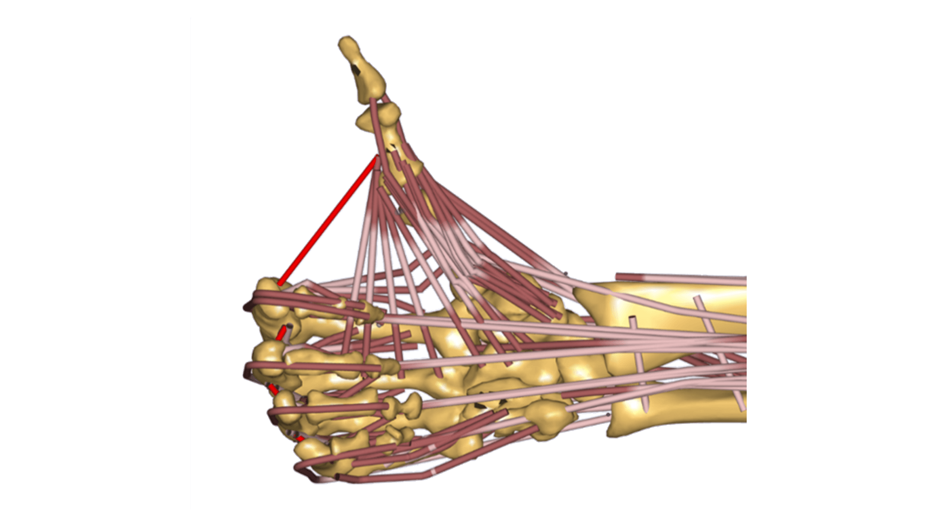 A new musculoskeletal AnyBody™ detailed hand model