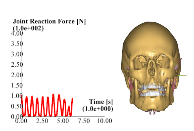 Mandible model