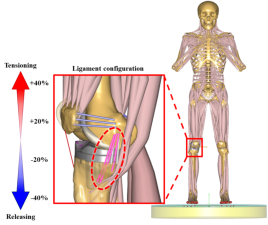 Impacts of ligament stiffness adjustment on knee joint mechanics in mechanically aligned PS-TKA