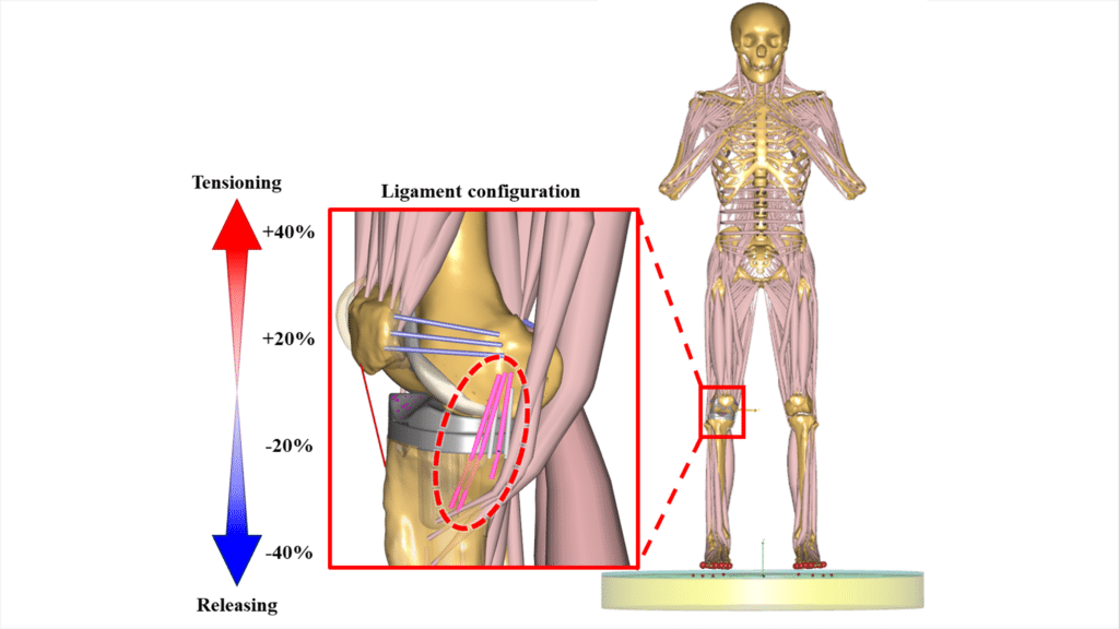 Impacts of ligament stiffness adjustment on knee joint mechanics in ...